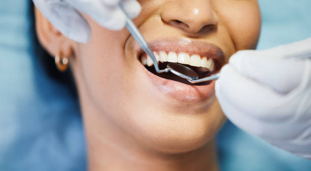Best Emergency Broken Tooth Repair in Union, KY