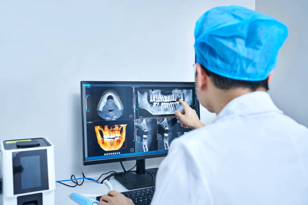 Best Emergency Root Canal Treatment in Union, KY